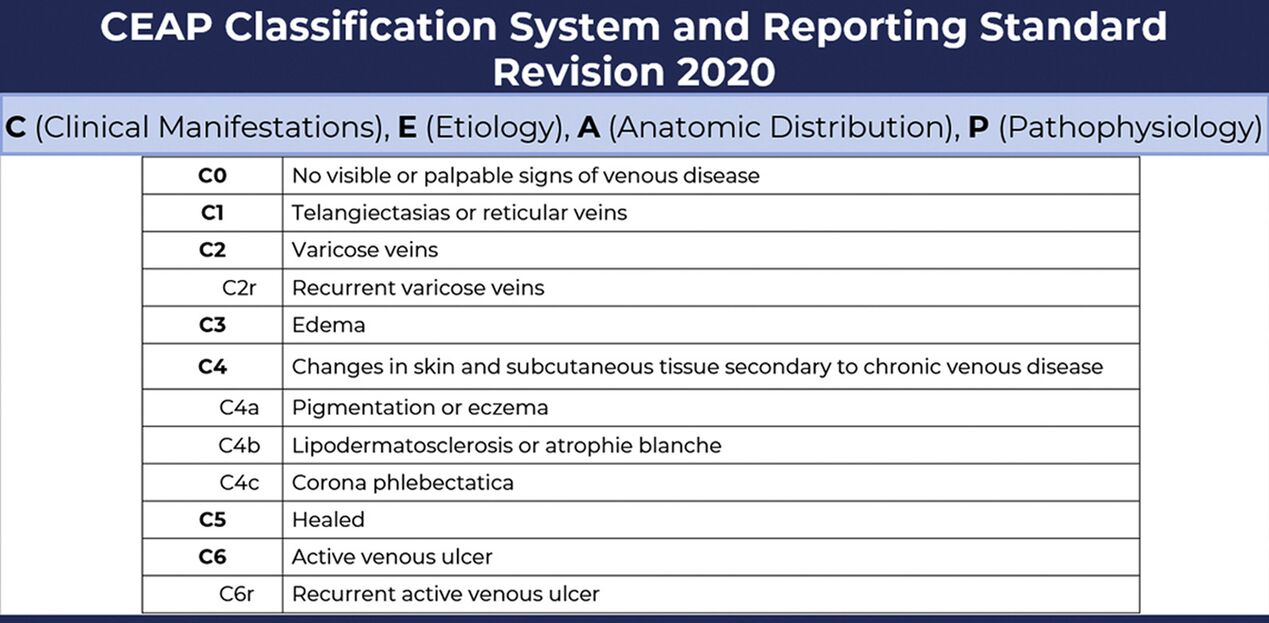 Stages of varicose veins according to the 2020 revised CEAP classification